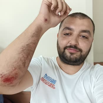 Ön Koruma Demiri Arızası Nedeniyle Yaşanan Güvenlik Sorunu