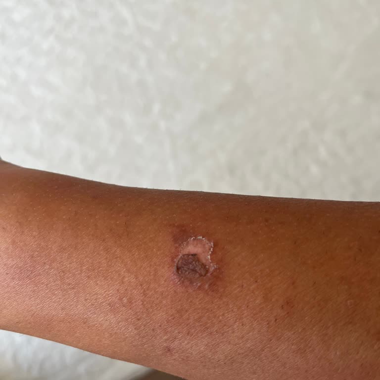 Gülümser Koç Estetik & Güzellik Epilasyon Sonrası Yanıklar Ve Etkisiz Seanslar