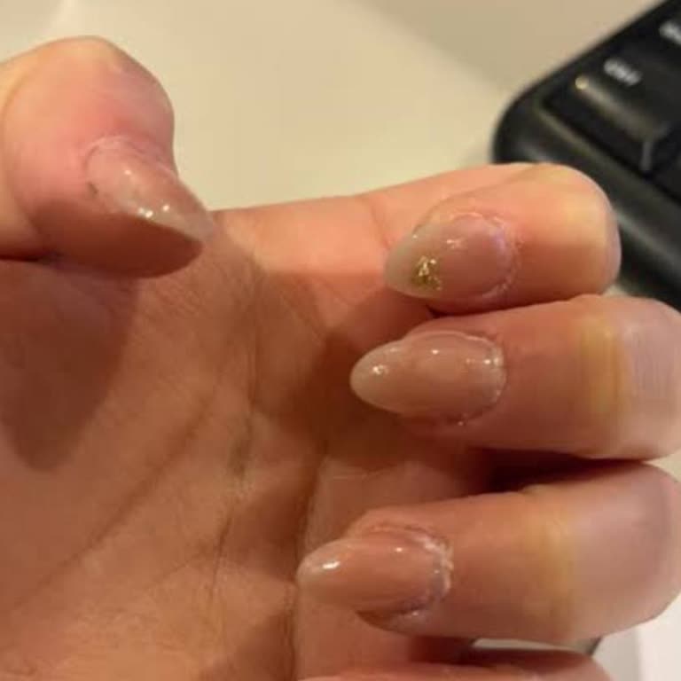 Çilek Nail House Protez İşleminde Kötü Hizmet Ve Saygısız Davranış