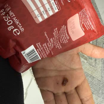 BİM Simbat Gün Kurusunda Çıkan Çakıl Oğlumun Dişini Kırdı