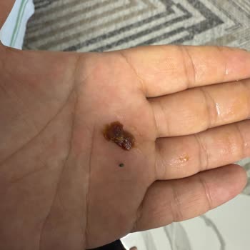 BİM Simbat Gün Kurusunda Çıkan Çakıl Oğlumun Dişini Kırdı