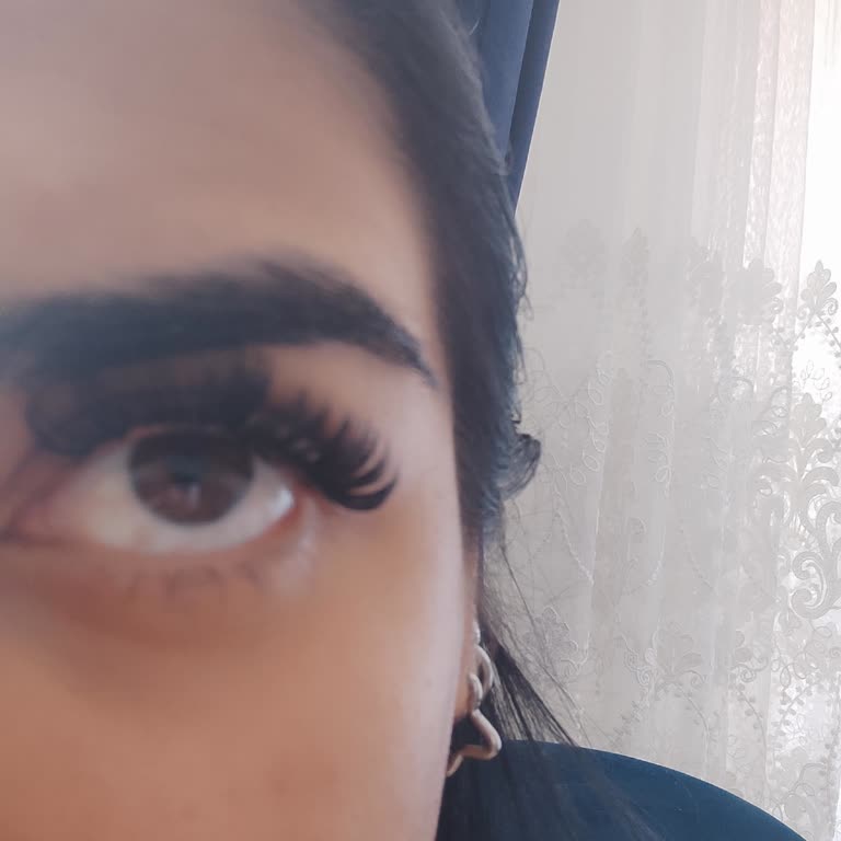 Yanlış Bilgilendirme Ve Yetersiz Hizmet Nedeniyle Memnuniyetsizlik