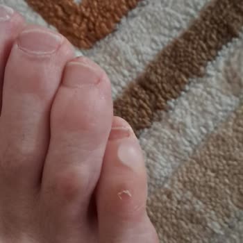 Aldığım Terlikler Ayağımı Yaraladı, İade Talebim Reddedildi