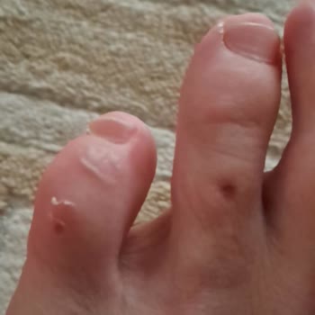 Aldığım Terlikler Ayağımı Yaraladı, İade Talebim Reddedildi