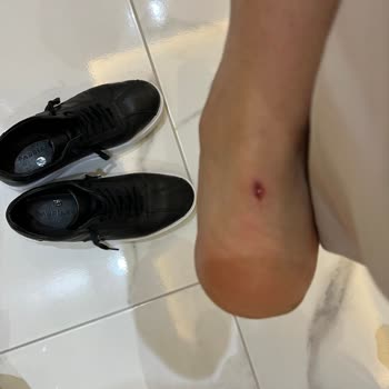 Aldığım Ayakkabı İlk Giydiğimde Ayağımı Rahatsız Etti
