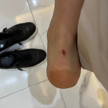 Aldığım Ayakkabı İlk Giydiğimde Ayağımı Rahatsız Etti