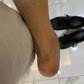 Aldığım Ayakkabı İlk Giydiğimde Ayağımı Rahatsız Etti