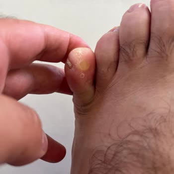 Skechers Ayakkabıda İnceleme Süreci Ve Müşteri Memnuniyetsizliği