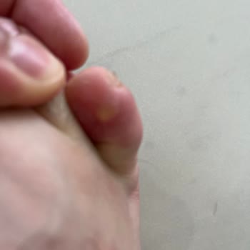 Skechers Ayakkabıda İnceleme Süreci Ve Müşteri Memnuniyetsizliği