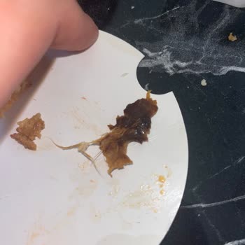 Tavuk Dönerde Tüy Şoku: Hijyen Skandalı Ve Güven Kaybı