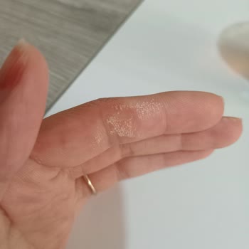 Kullandığım Ürün Elimi Yaktı, Acile Başvurdum