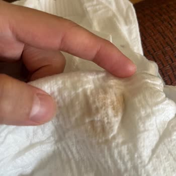 Bebek Bezinde Yabancı Cisim Bulduk, Güvenimiz Sarsıldı
