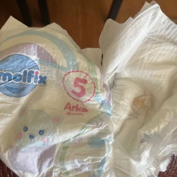 Bebek Bezinde Yabancı Cisim Bulduk, Güvenimiz Sarsıldı