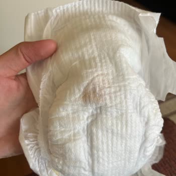 Bebek Bezinde Yabancı Cisim Bulduk, Güvenimiz Sarsıldı