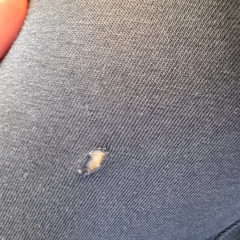 Arçelik Garanti Biter Bitmez Tekrarlayan Kazan Sorunu ve Yırtılan Kıyafetler