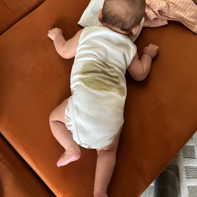 Molfix 3 Numara Bebek Bezi Sürekli Sızdırıyor, Kıyafetler Kirleniyor