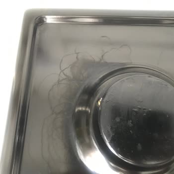 Beko Ürünümde Lekeler Ve Yetersiz Servis Çözümü