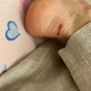 Ayakkabı Ayağımı Yaraladı, İade Sürecinde Mağduriyet Yaşadım