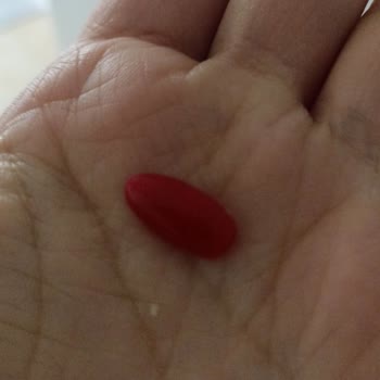 Diora Beauty Clinic Müşteri Memnuniyetsizliği