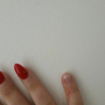 Diora Beauty Clinic Müşteri Memnuniyetsizliği