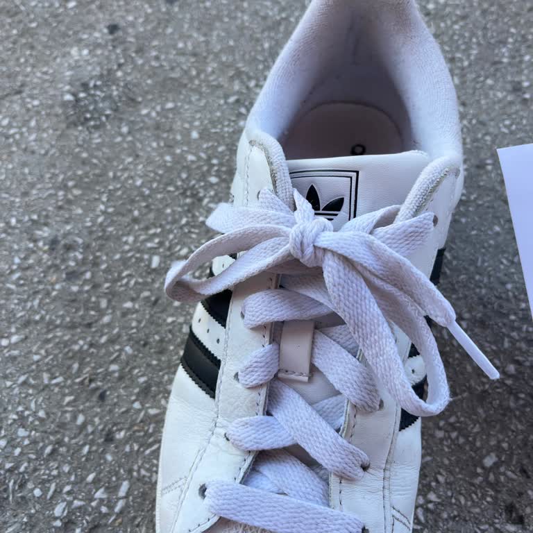 Ayakkabıda Tülerme Sorunu Ve İlgisiz İnceleme Sonucu