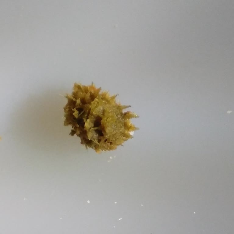 Dondurulmuş Bezelyede Tehlikeli Yabancı Cisim Şoku!