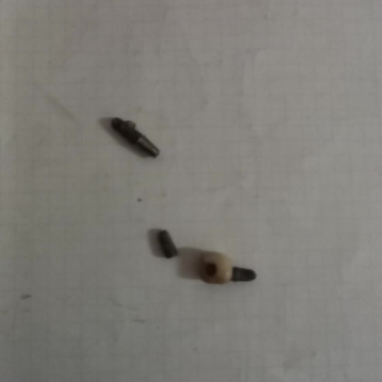 Klinikadent Peşin Ödeme Sonrası İmplantlar Düştü, Hizmet Ve Fatura Yok