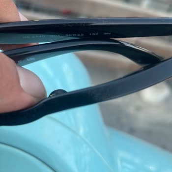 Satın Aldığım Gözlükte Bir Haftada Lekelenme Ve Destek Sorunu