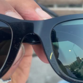 Satın Aldığım Gözlükte Bir Haftada Lekelenme Ve Destek Sorunu