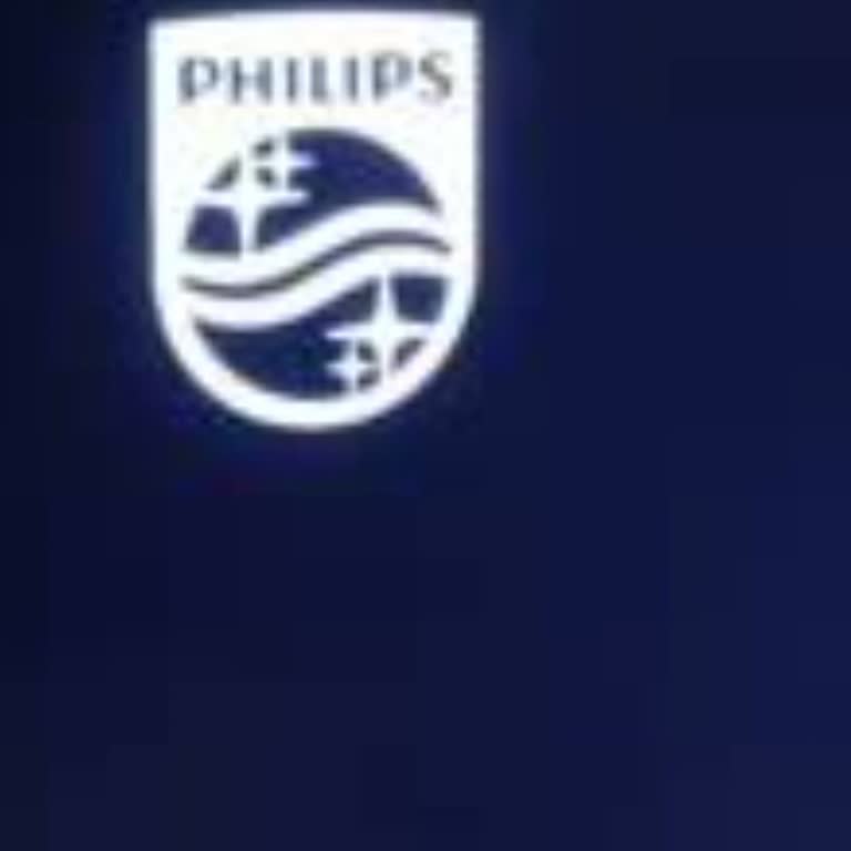 Güncelleme Sonrası TV Çalışmıyor, Masraflar Tarafıma Yüklendi