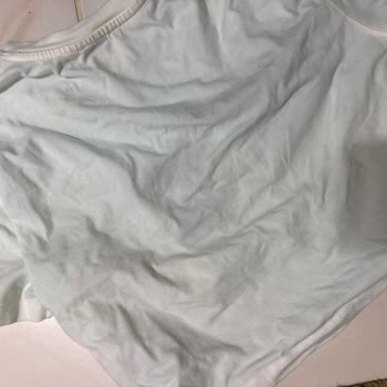 Havuzdaki Kimyasal Nedeniyle Saçlarım Yandı Ve Sağlığımız Tehlikeye Girdi