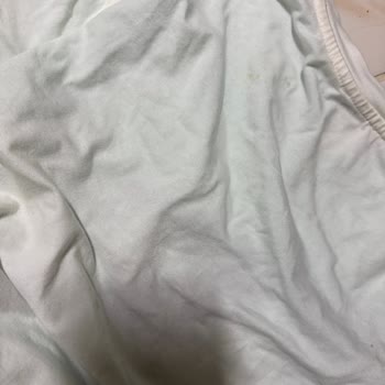 Havuzdaki Kimyasal Nedeniyle Saçlarım Yandı Ve Sağlığımız Tehlikeye Girdi