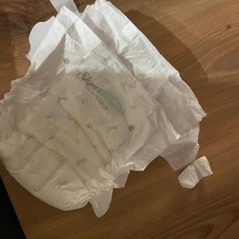 Sleepy Bionaturel Bebek Bezlerinde Sürekli Cırt Kısmı Kopması Ve Kalite Sorunu