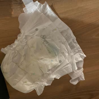 Sleepy Bionaturel Bebek Bezlerinde Sürekli Cırt Kısmı Kopması Ve Kalite Sorunu