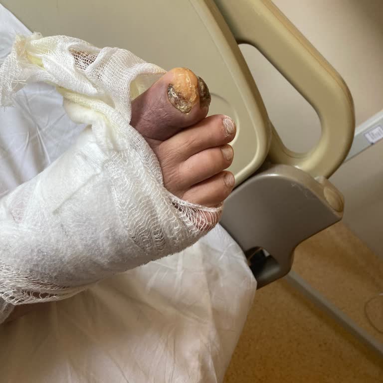 Cerrah Eksikliği Nedeniyle Tedavi Edilemeyen Tırnak Batması Sonucu Mağduriyet