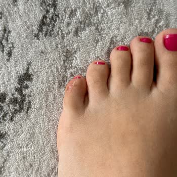 Aldığım Sandalet Ayağımı Yaraladı, Mağaza İlgisiz Davrandı