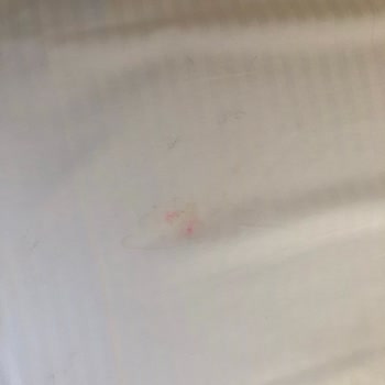 Tropical Deluxe Hotel Yemekleri Aşırı Kötü