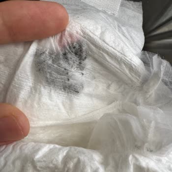 Bebek Bezinden Çıkan Siyah Yabancı Madde Güvenimizi Sarstı