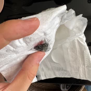 Bebek Bezinden Çıkan Siyah Yabancı Madde Güvenimizi Sarstı