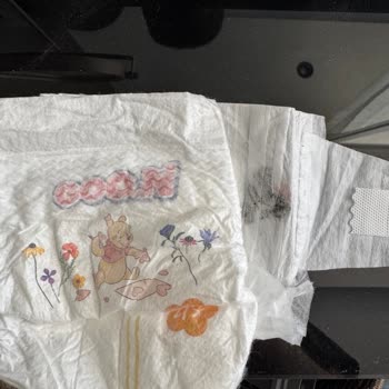 Bebek Bezinden Çıkan Siyah Yabancı Madde Güvenimizi Sarstı