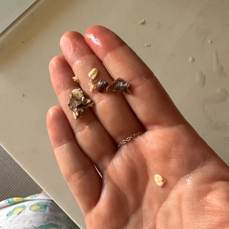 Severek Kullandığım Üründen Çıkan Yabancı Cisim Şaşkınlığı