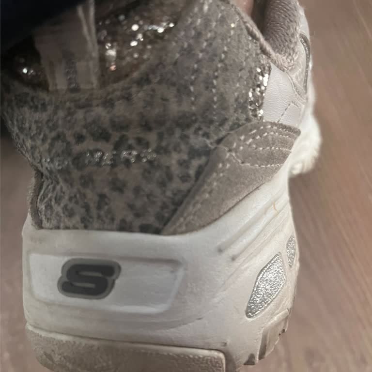 Skechers Ayakkabım Kısa Sürede Deforme Oldu, Mağaza İlgisiz Kaldı