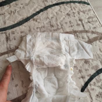 Molfix Bezlerde Sürekli Sorun Ve Çözüm Bulunamıyor