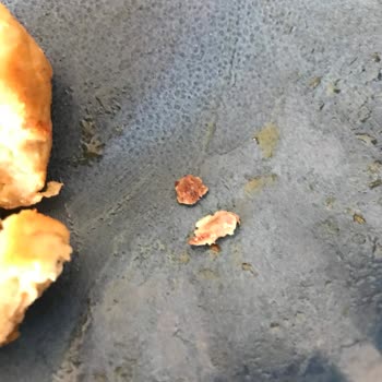 Dondurulmuş Köftede Kemik Ve Yabancı Maddelerle Karşılaştım