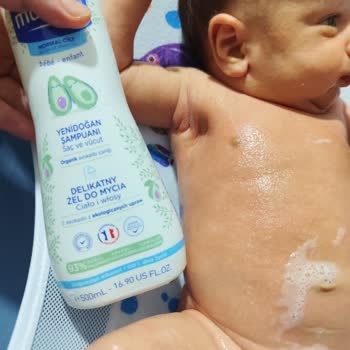 Mustela Bebek Şampuanı Alerji Yaptı Ve Vücudu Kabardı