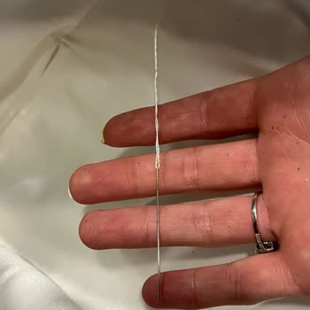 Düğün Günü Hayal Kırıklığı: Eksik Ve Hatalı Gelinlik Teslimatı