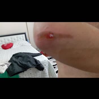 Lüks Niksar Tur Bagaj Ücreti Tartışması Ve Personel Davranışları