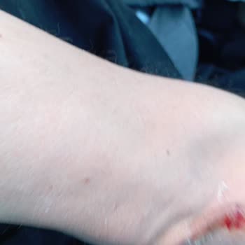 Lüks Niksar Tur Bagaj Ücreti Tartışması Ve Personel Davranışları