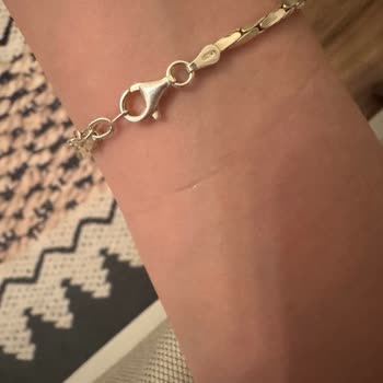 Aldığım Bilekliğin Rengi Attı, Kusurun Giderilmesini İstiyorum