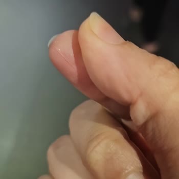 Kahvede Cam Parçalarıyla Karşılaştık, Çalışanlar Önlem Almadı